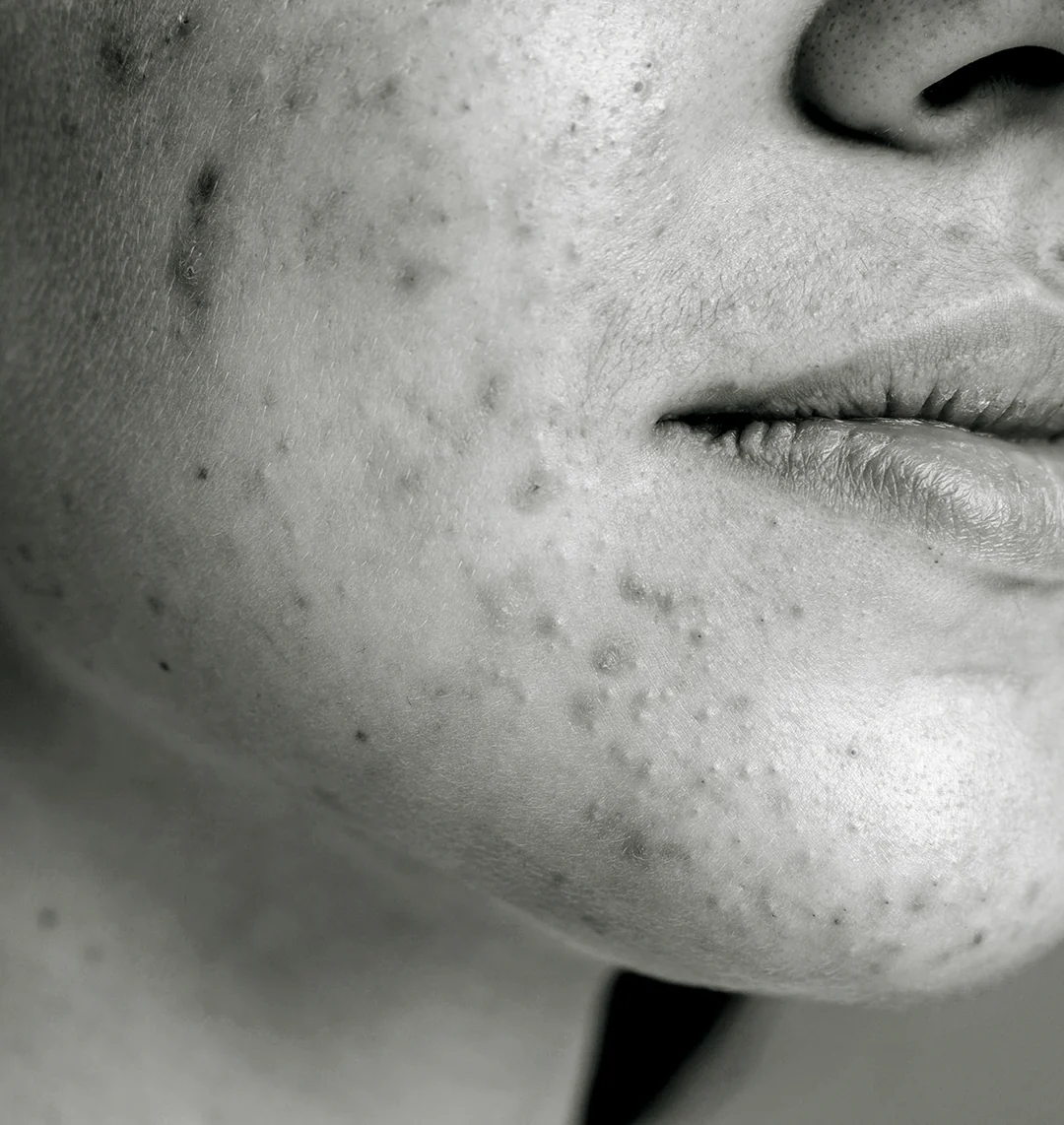 Blue Skin Laser Spa clinical skin solutions