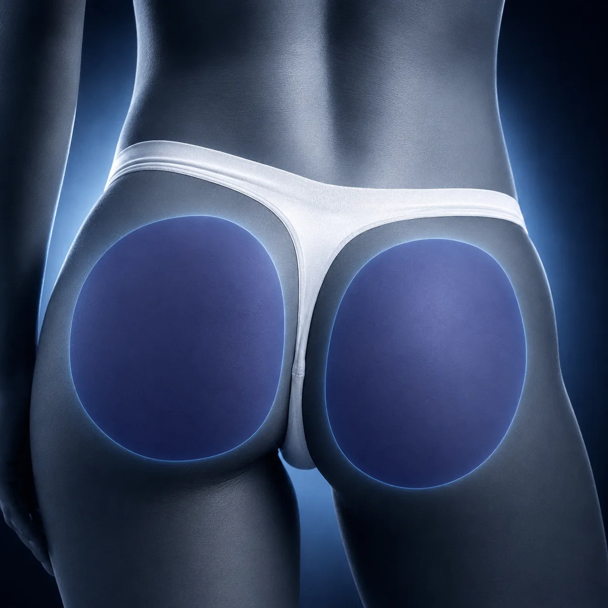 Full Butt Laser Hair Removal