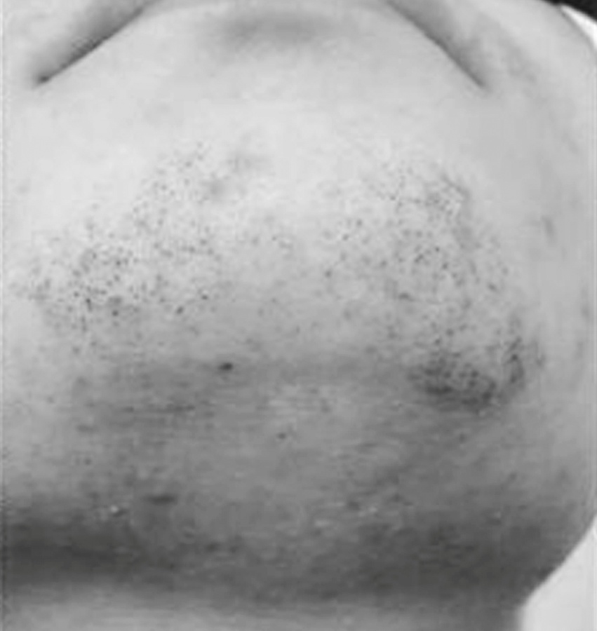 Higher Testosterone Level Clinical Evaluation NYC