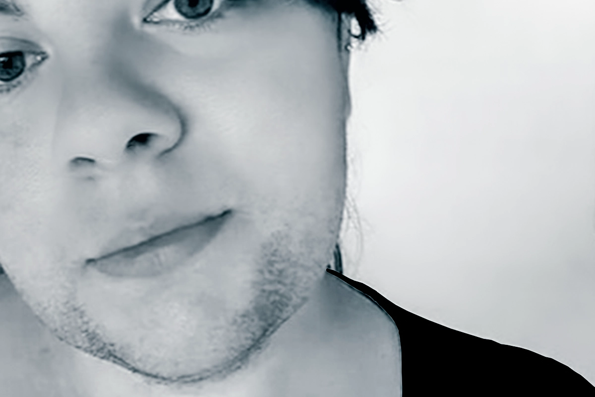 Hirsutism and PCOS Treatment in NYC