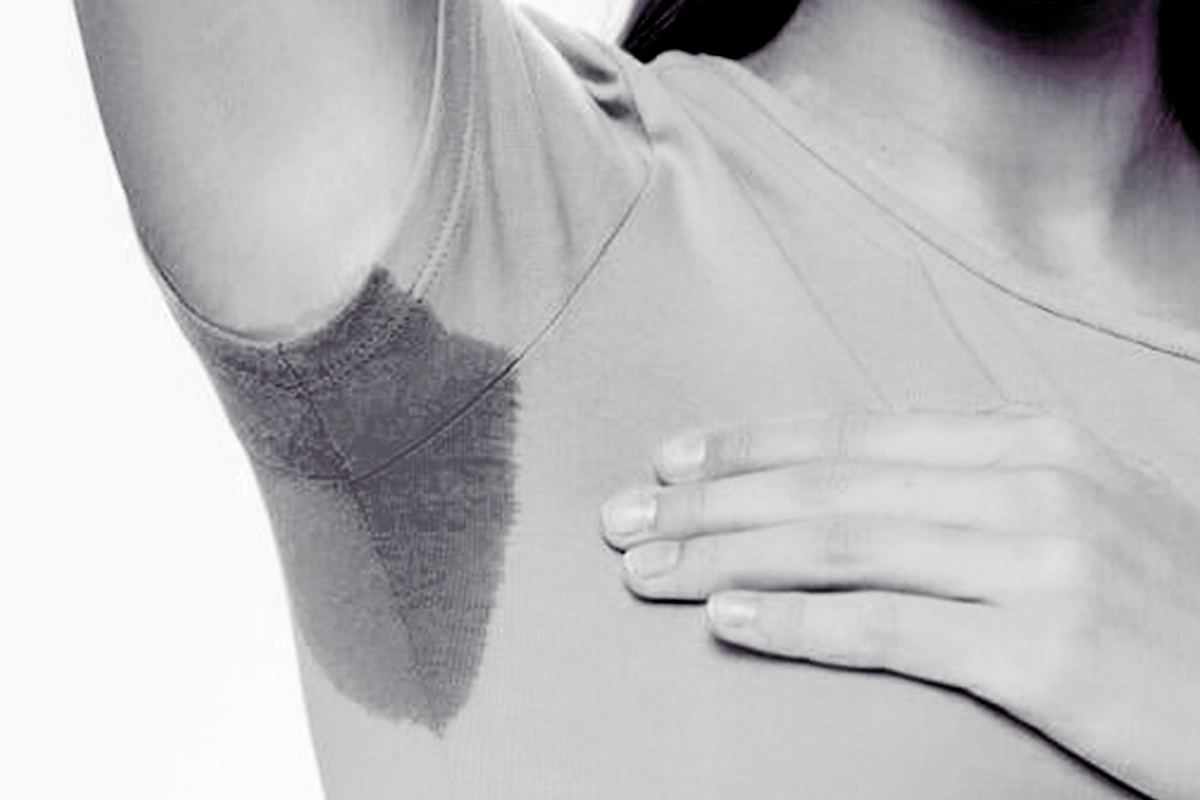 Hyperhidrosis Excessive Sweating Treatment in NYC