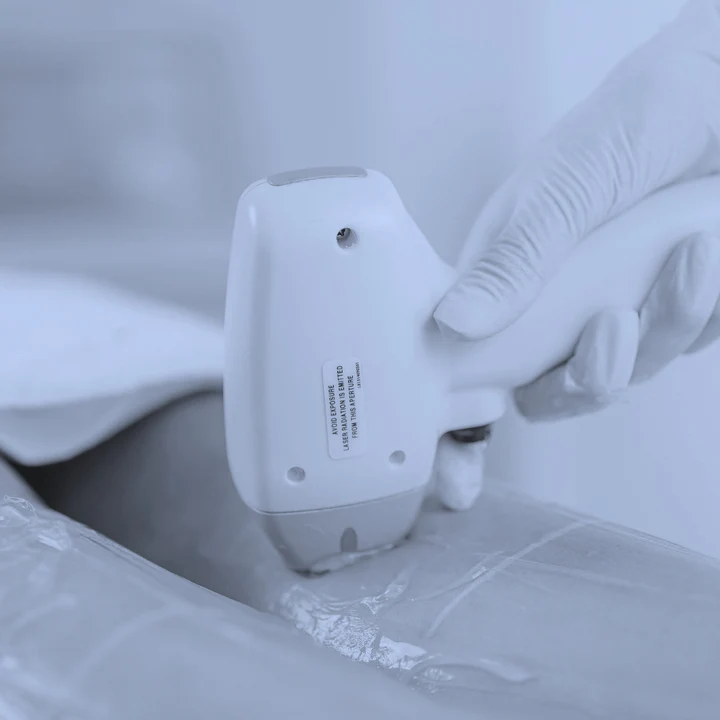 Laser Treatments