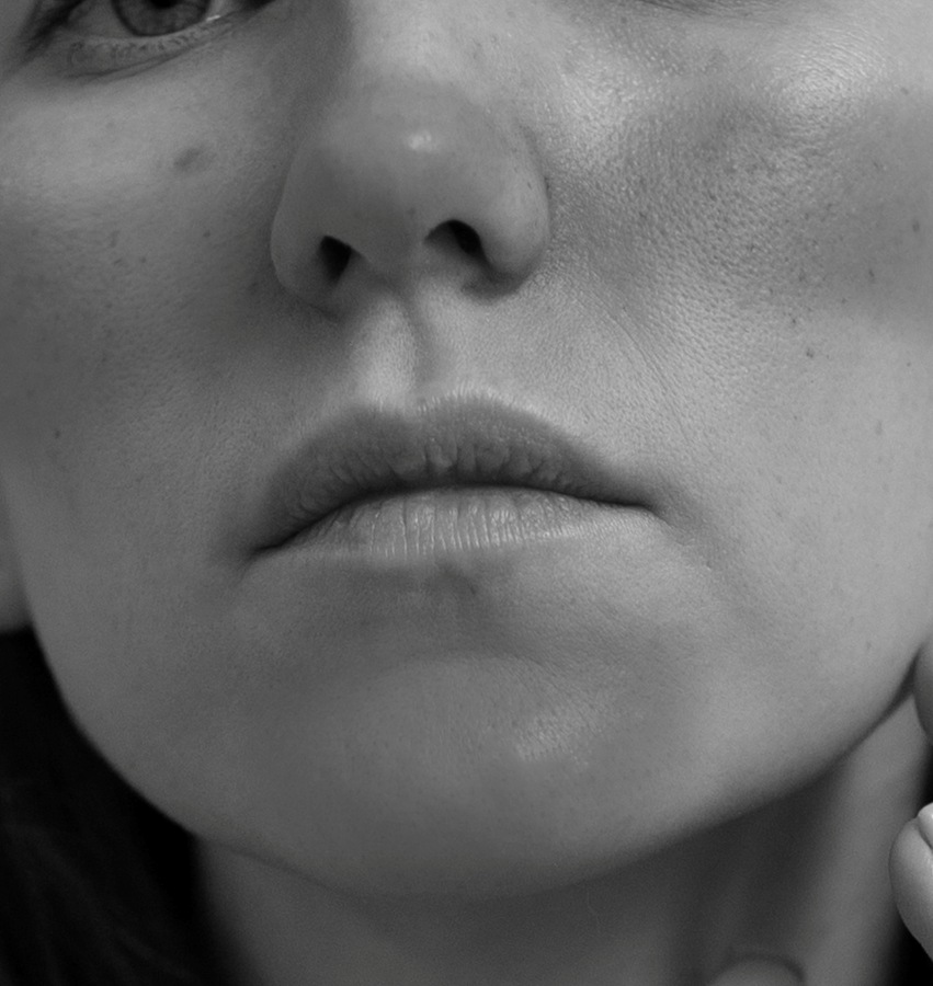 Rosacea Skin Condition Treatment in NYC